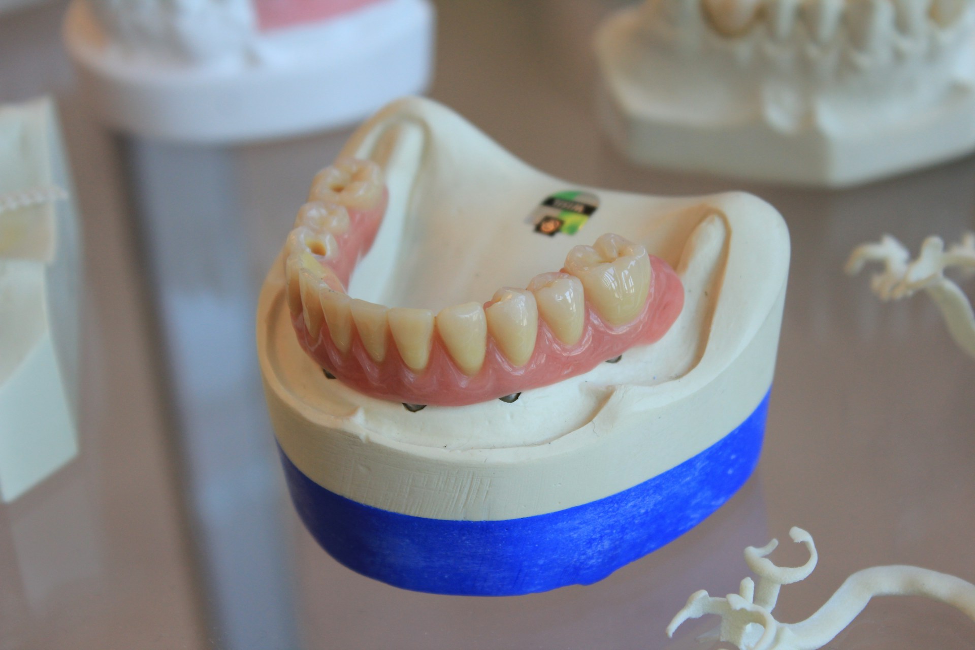 Same Day Denture Repair: Emergency Solutions for Busy Lifestyles